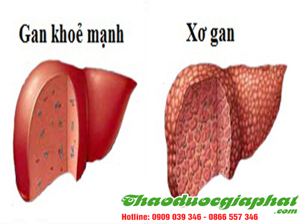 ba-kich-tim-dieu-tri-xo-gan-tai-quan-2