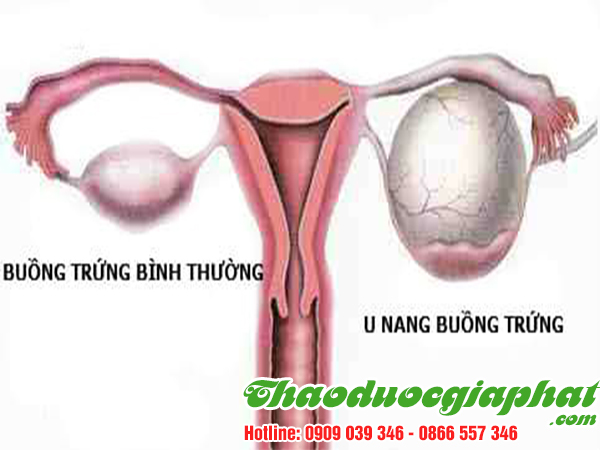 ba-kich-tim-tri-u-nang-buong-trung-tai-quan-6.