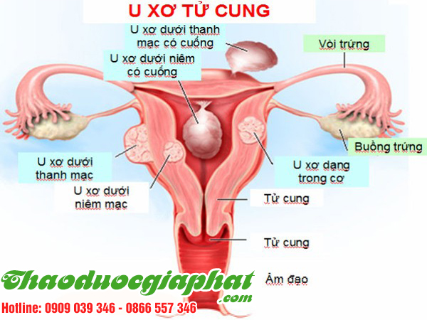 ba-kich-tim-tri-u-xo-tu-cung-tai-quan-8