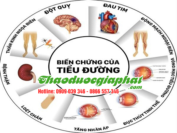 cam-thao-dat-dieu-tri-tieu-duong-tai-quan-2