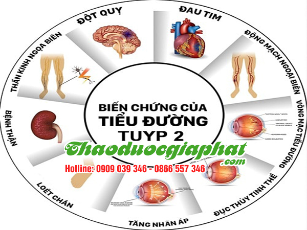 cam-thao-dat-dieu-tri-tieu-duong-tuyt-2-tai-quan-9