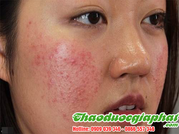 cau-ki-tu-giup-tri-da-san-sui-tai-huyen-cu-chi