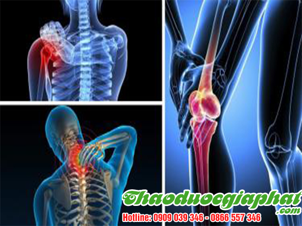 cau-ki-tu-tri-dau-nhuc-xuong-khop-tai-huyen-can-gio