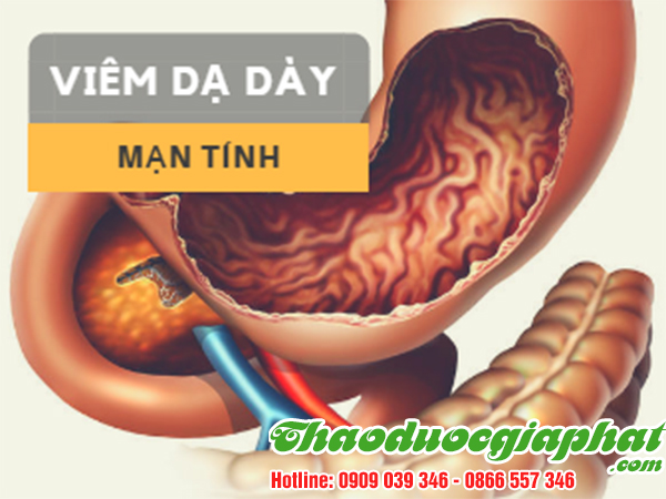 cau-ki-tu-tri-viem-da-day-man-tinh-tai-huyen-nha-be