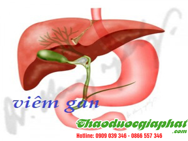 cay-bi-ki-nam-tri-viem-gan-tai-quan-6