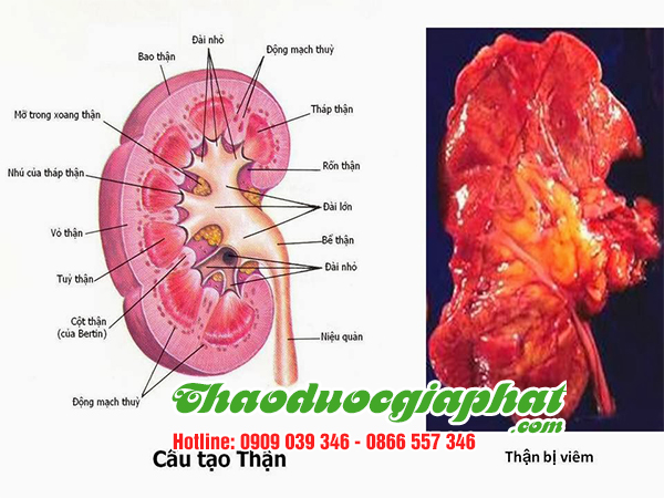cay-bi-ki-nam-tri-viem-than-tai-quan-11