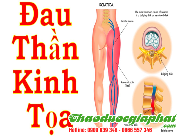 cay-chia-voi-tai-quan-7-tri-dau-than-kinh-toa
