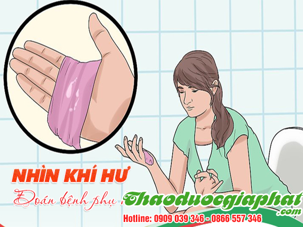 cay-hoang-ky-tri-khi-hu-tai-quan-6