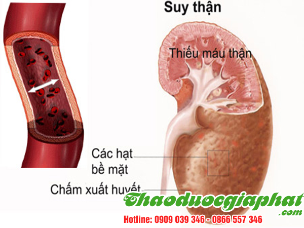 cay-hoang-ky-tri-suy-than-tai-quan-3