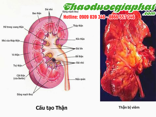 cay-hoang-ky-tri-viem-than-tai-quan-11