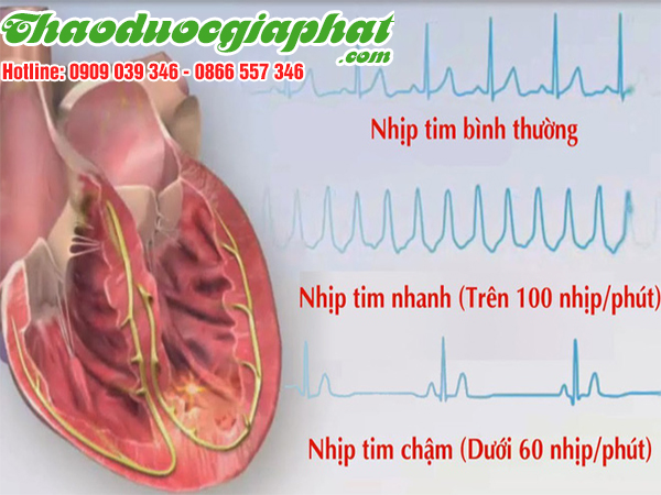 cay-mach-mon-chong-roi-loan-nhip-tim-tai-huyen-cu-chi