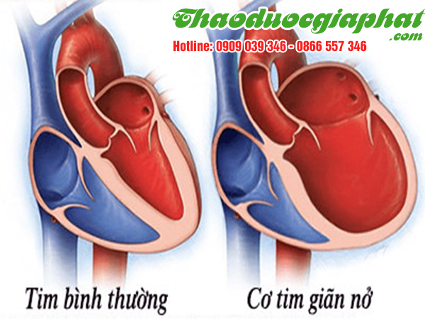 cay-mach-mon-giup-nang-cao-chuc-nang-co-bop-tim-tai-quan-7