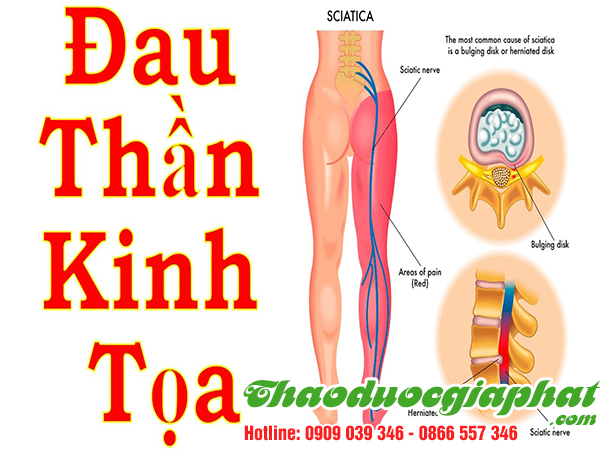 cay-tom-trong-tri-dau-than-kinh-toa-tai-quan-3