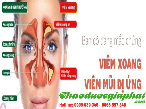 cay-tom-trong-dieu-tri-viem-xoang-di-ung-tai-quan-thu-duc
