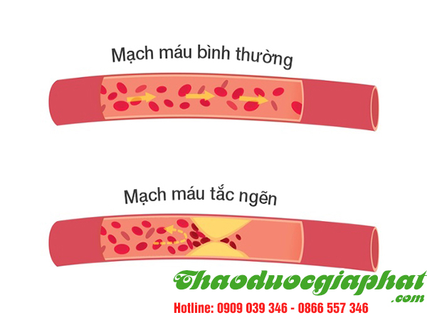 cay-tom-trong-giup-cai-thien-lu-thong-tuan-hoan-tai-quan-binh-tan
