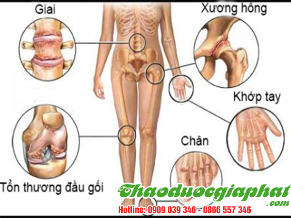 cay-voi-voi-tri-nhuc-moi-xuong-khop-tai-huyen-cu-chi