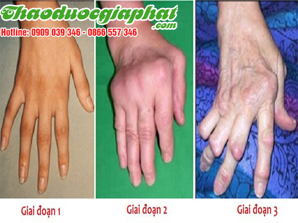 cay-voi-voi-tri-te-bai-phong-thap-tai-huyen-hoc-mon