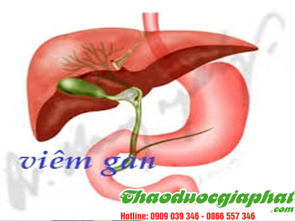 cay-xuong-khi-tri-viem-gan-tai-quan-6