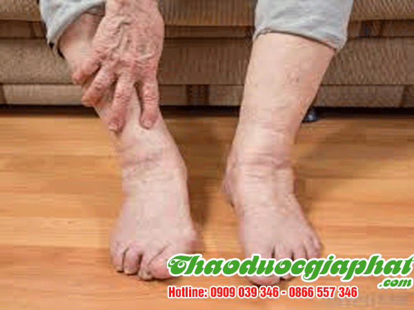 day-gam-chua-tri-te-thap-tot-nhat-tai-quan-9