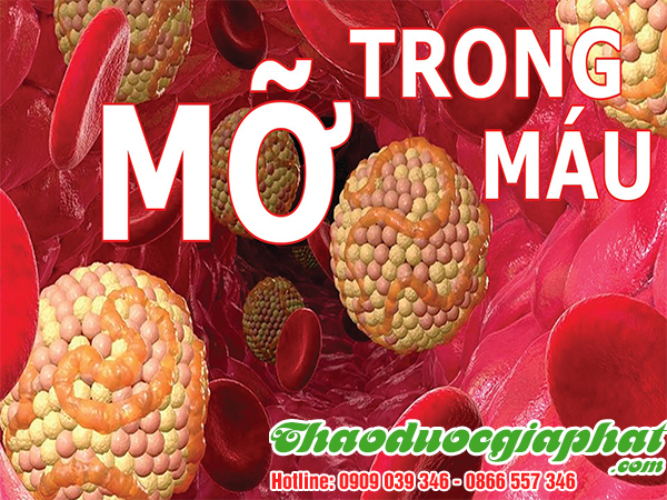 la-mang-cau-tri-mo-trong-mau-tai-huyen-cu-chi