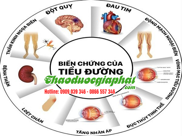 la-mang-cau-tri-tieu-duong-tai-quan-12