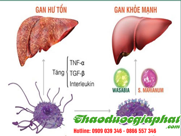 la-mang-cau-tri-viem-gan-tai-huyen-hoc-mon