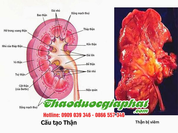 la-mang-cau-tri-viem-than-tai-huyen-nha-be