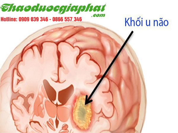 nam-lim-xanh-tri-u-nao-ac-tinh-tai-quan-binh-thanh