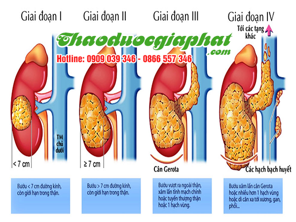 nam-lim-xanh-tri-ung-thu-than-tai-quan-10