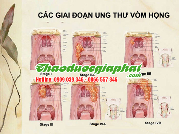 nam-lim-xanh-tri-ung-thu-vom-hong-tai-quan-3