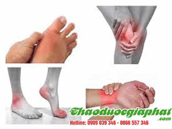 cay-kien-co-tri-viem-xuong-khop-tot-nhat-tai-quan-10