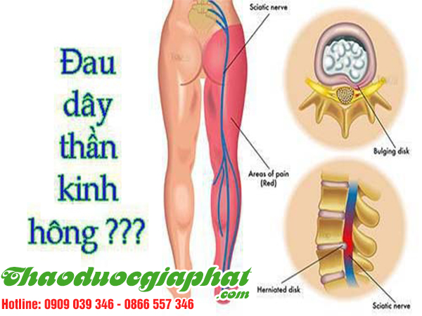 sam-duong-quy-tri-dau-day-than-kinh-tai-huyen-cu-chi