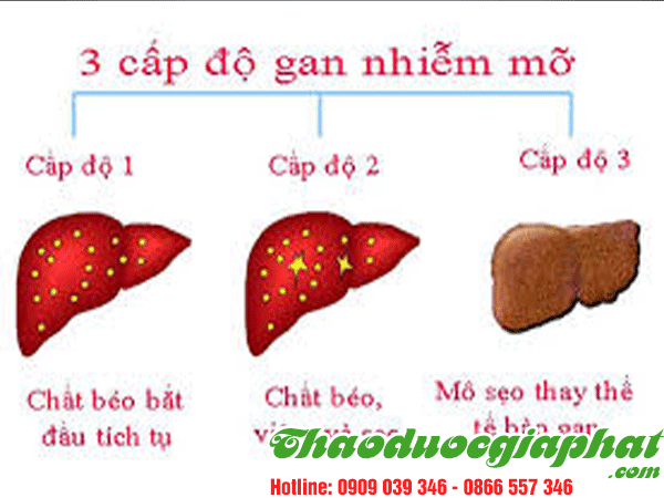 tao-meo-tri-gan-nhiem-mo-tai-quan-tan-phu.