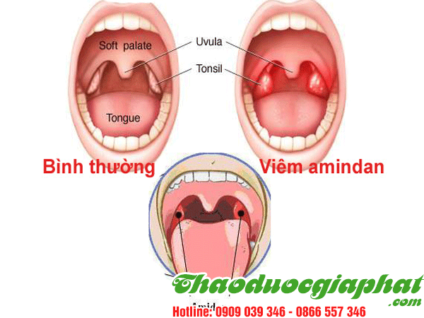 tao-meo-tri-viem-amidan-tai-huyen-binh-chanh.