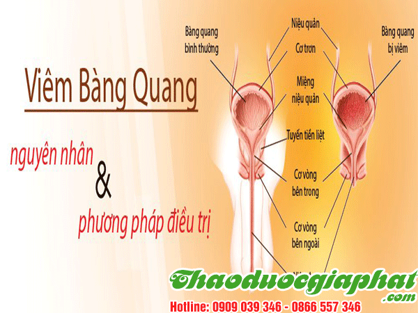 tao-meo-tri-viem-bang-quang-tai-quan-7