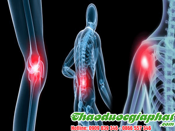 thang-thuoc-minh-mang-tri-viem-xuong-khop-tot-nhat-tai-quan-go-vap