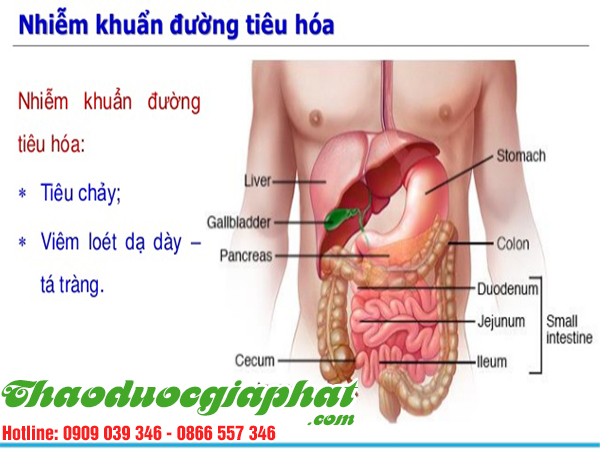 xuyen-tam-lien-tri-viem-nhiem-duong-tieu-hoa-tai-huyen-hoc-mon