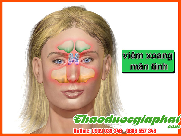 xuyen-tam-lien-tri-viem-xoang-man-tai-quan-go-vap