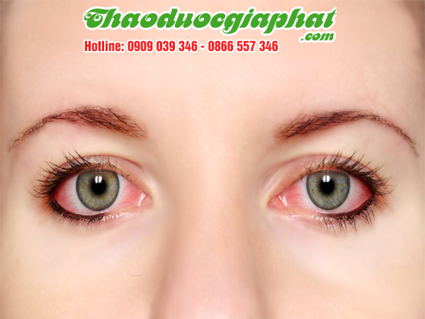 bach-chi-tri-dau-mat-tai-quan-1