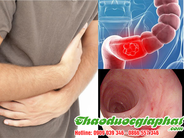 bach-chi-tri-ruot-co-mu-mau-tai-quan-9