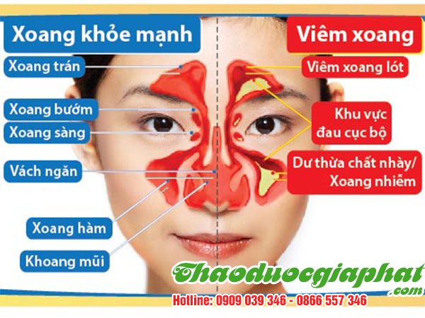 bach-chi-tri-viem-xoang-tai-quan-7