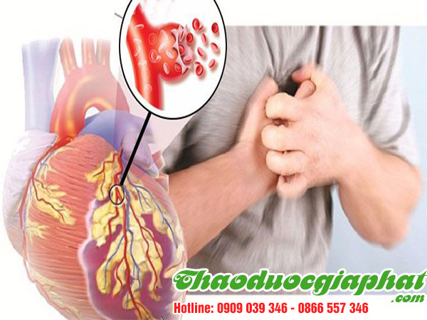 bot-que-bao-ve-tim-tai-huyen-cu-chi