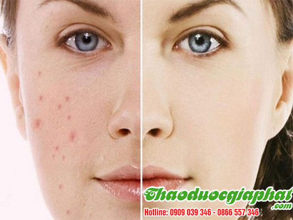 bot-que-giup-lam-dep-da-tai-quan-tan-phu