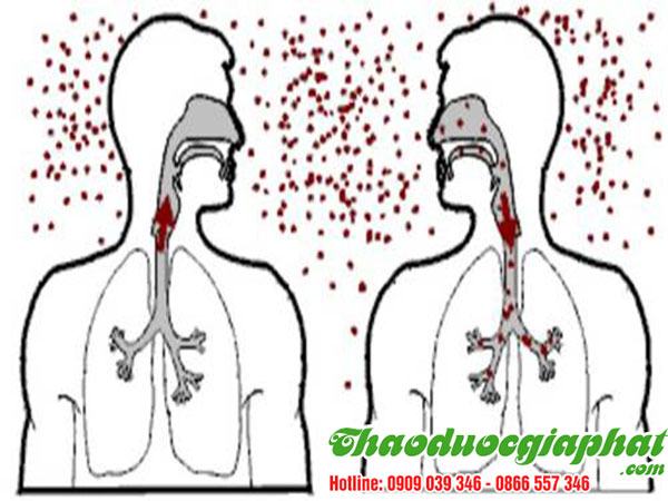 bot-que-tri-benh-truyen-nhiem-tai-quan-11