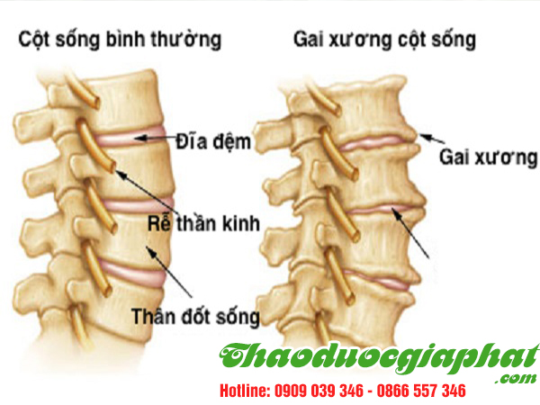 cay-bim-bip-tai-quan-7-uy-tin-tri-thoat-vi-dia-dem