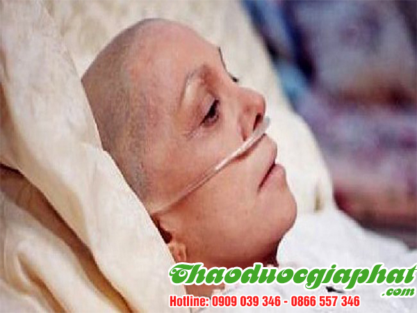 cay-bim-bip-tai-quan-phu-nhuan-uy-tin-tri-ung-thu