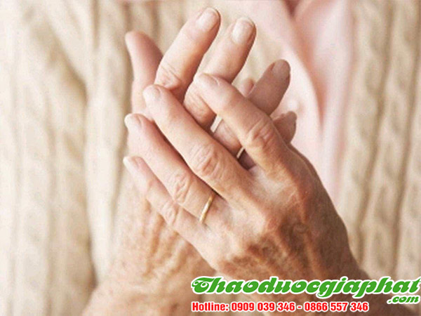 cay-ca-gai-leo-tri-thap-khop-tai-huyen-can-gio