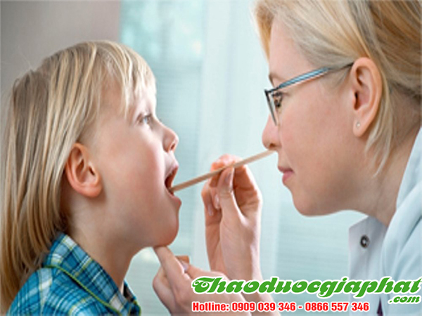 cay-ca-gai-leo-tri-viem-amidan-tai-quan-go-vap