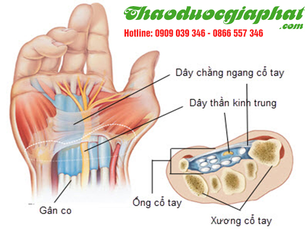 cay-ca-leo-tri-viem-gan-co-tai-quan-3