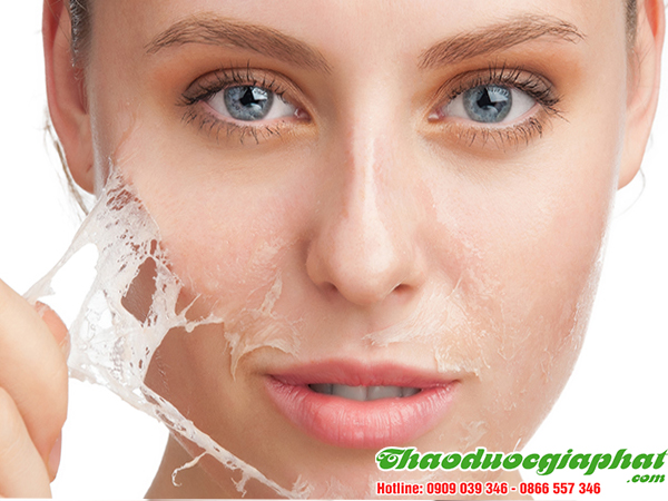 cay-mac-co-giup-tri-da-mat-kho-bong-troc-tai-quan-6